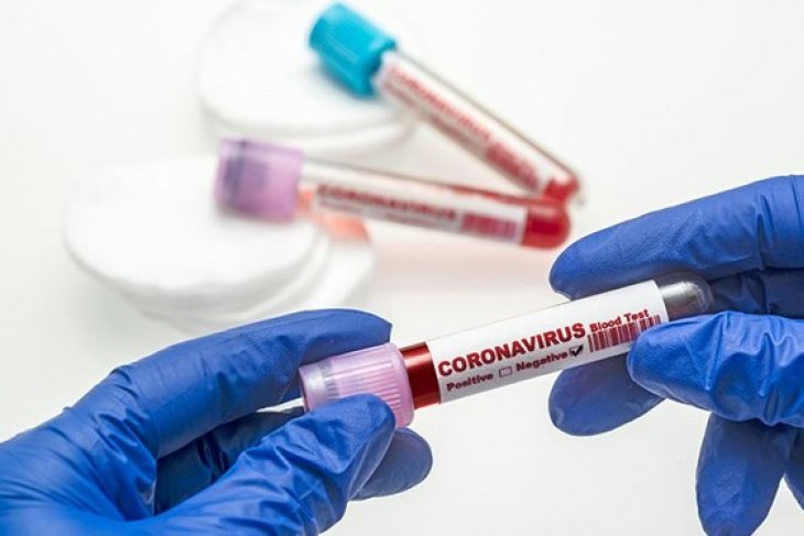 12 Ekim 2020 corona virüs tablosu 58 can kaybı bin 614 yeni hasta sayısı